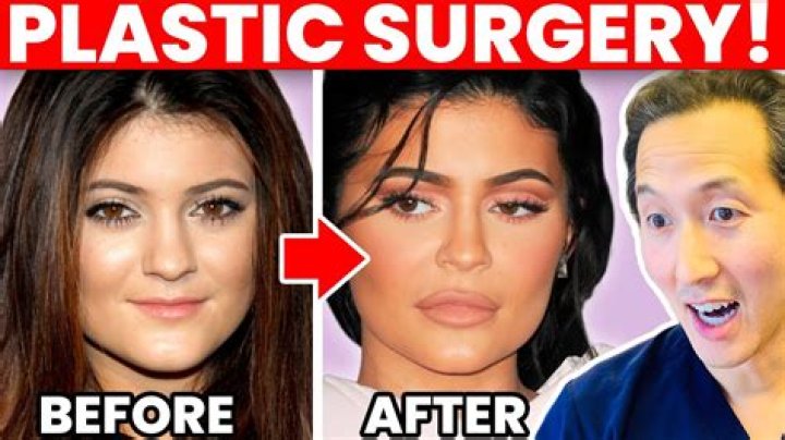 A Journey Of Transformation Through Plastic Surgery